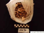 L_V20d5056 A16.96 R827 lR ta photo of skeletal condition.JPG L_V20d5056 A16.96 R827 lR ta photo of skeletal condition